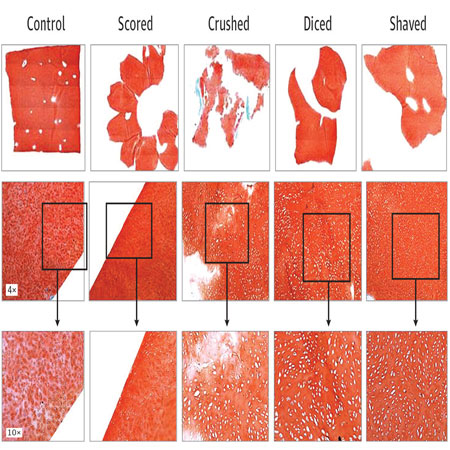 Characterization of Injury Induced by Routine Surgical Manipulations of Nasal Septal Cartilage