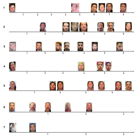 The Evolving Clinical Presentation of Acute Rejection in Facial Transplantation