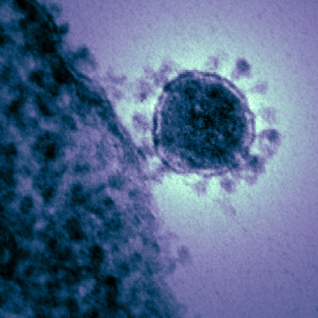 2019 Novel Coronavirus: An Update From NIAID Director Anthony Fauci, MD