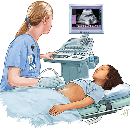 A Patient’s Perspective on Nonoperative Treatment of Appendicitis