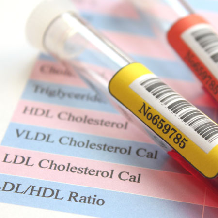 Screening for Familial Hypercholesterolemia