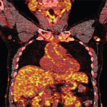 JAMA Cardiology Author Interviews