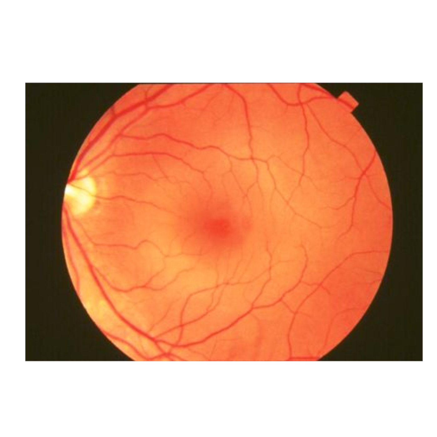 Do We Always See Clearly?