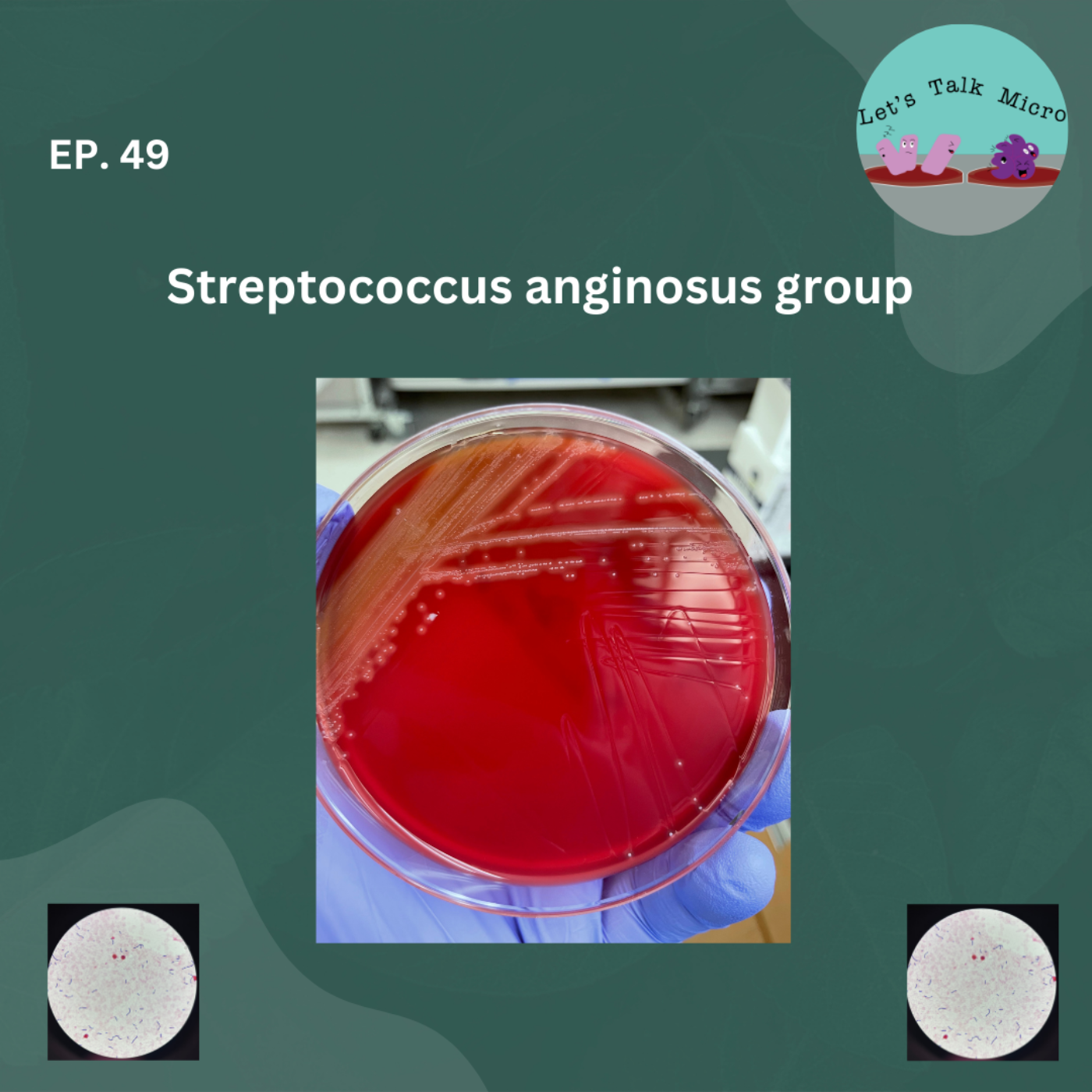 Episode 49: Streptococcus anginosus group
