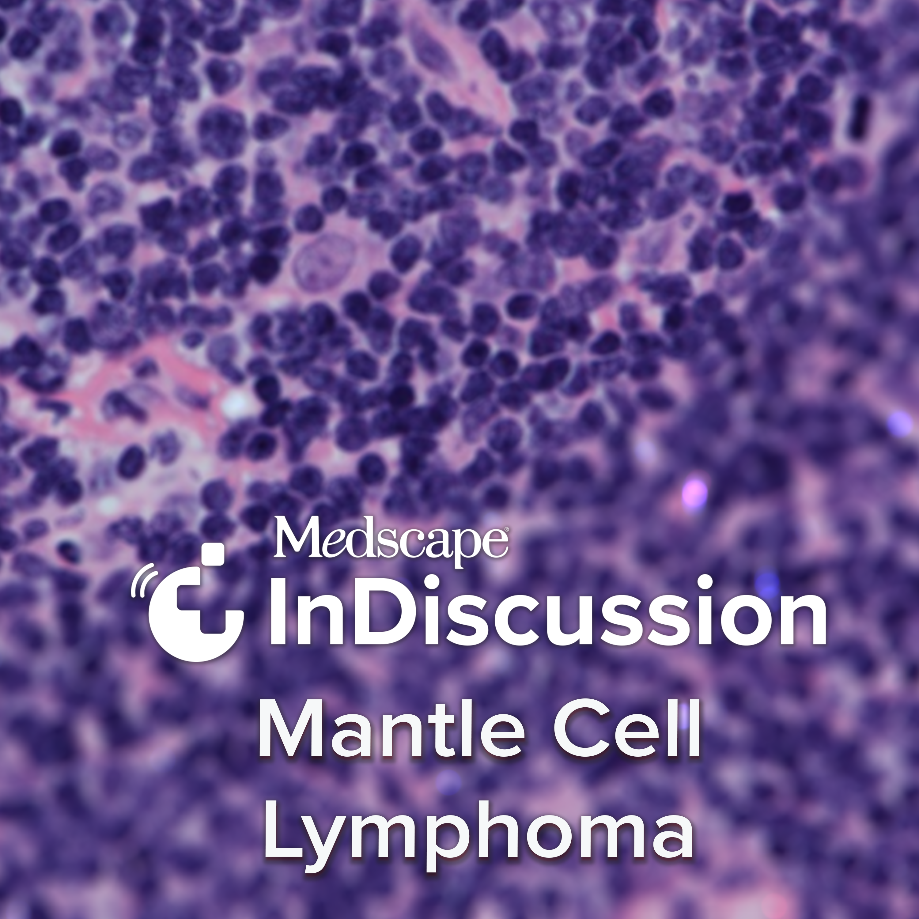 Medscape InDiscussion: Mantle Cell Lymphoma