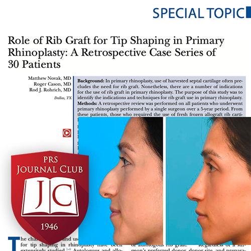 PRS Journal Club