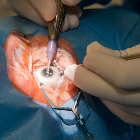 JAMA Ophthalmology Author Interviews