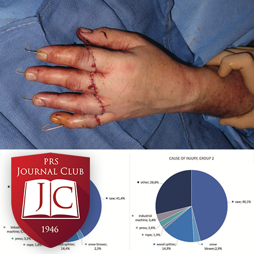 “Improving Patient Transfer Quality” with James Higgins, MD - Aug. 2025 Journal Club