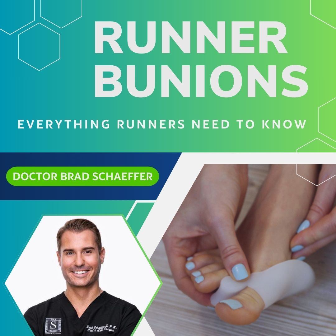 Everything Runners Need To Know About Bunions with Doctor Brad Schaeffer