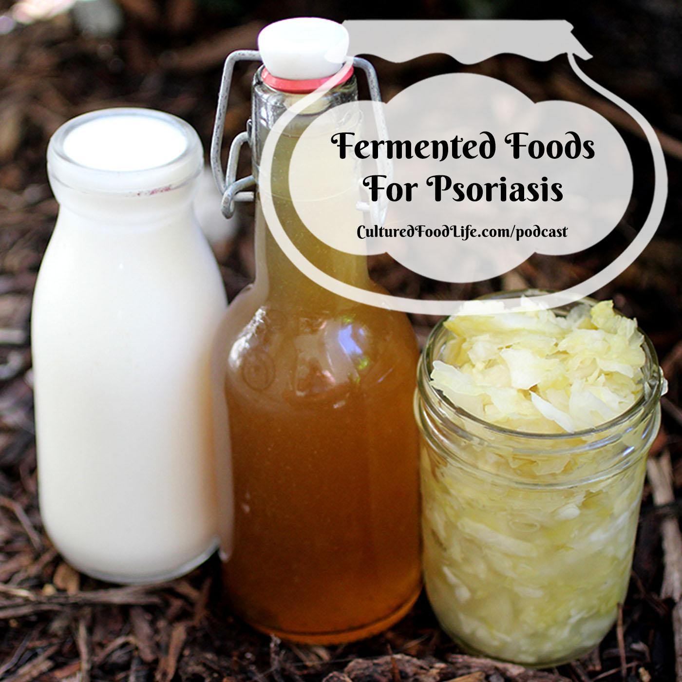 Episode 326: Fermented Foods For Psoriasis