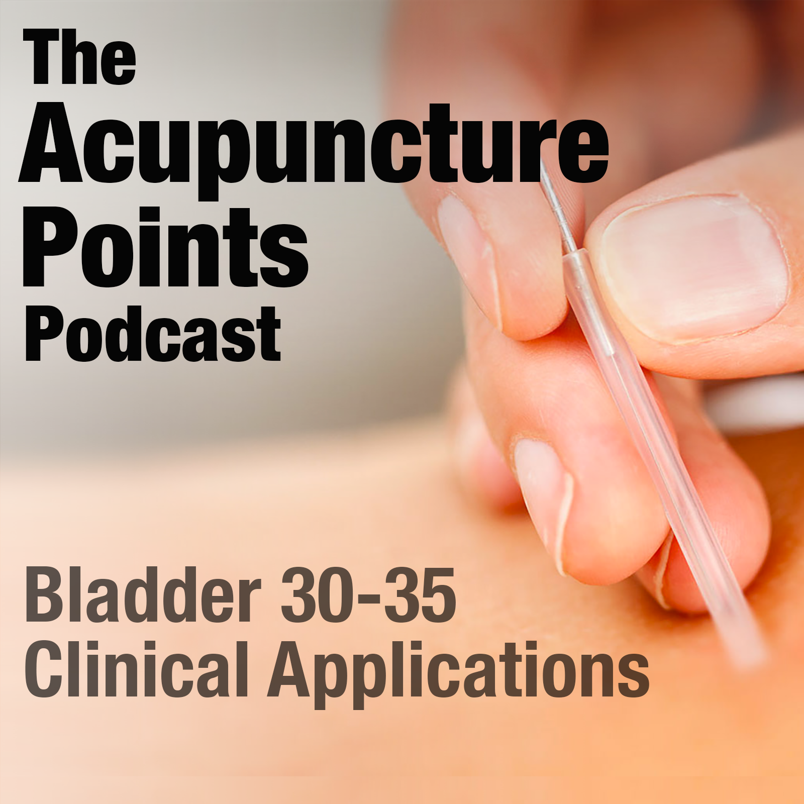 Acupuncture Points and their Clinical Application