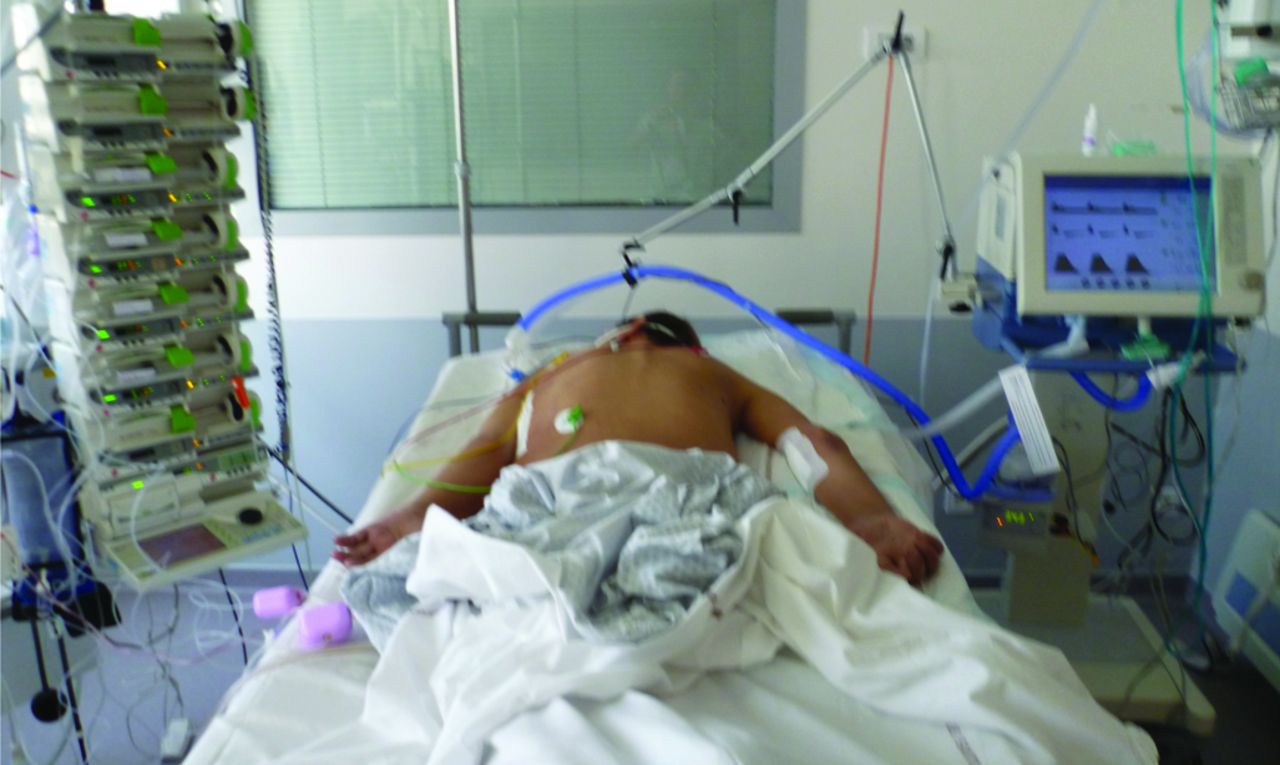 Podcast 558:  Rapid ARDS Review