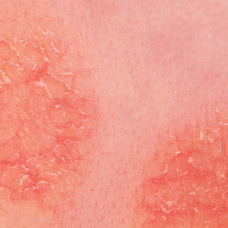 JAMA Clinical Reviews