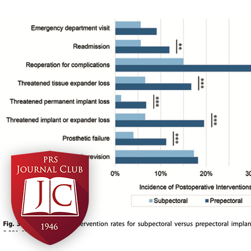 "Prepectoral versus Subpectoral Implants" with Andrea L. Pusic, MD - May 2026 Journal Club