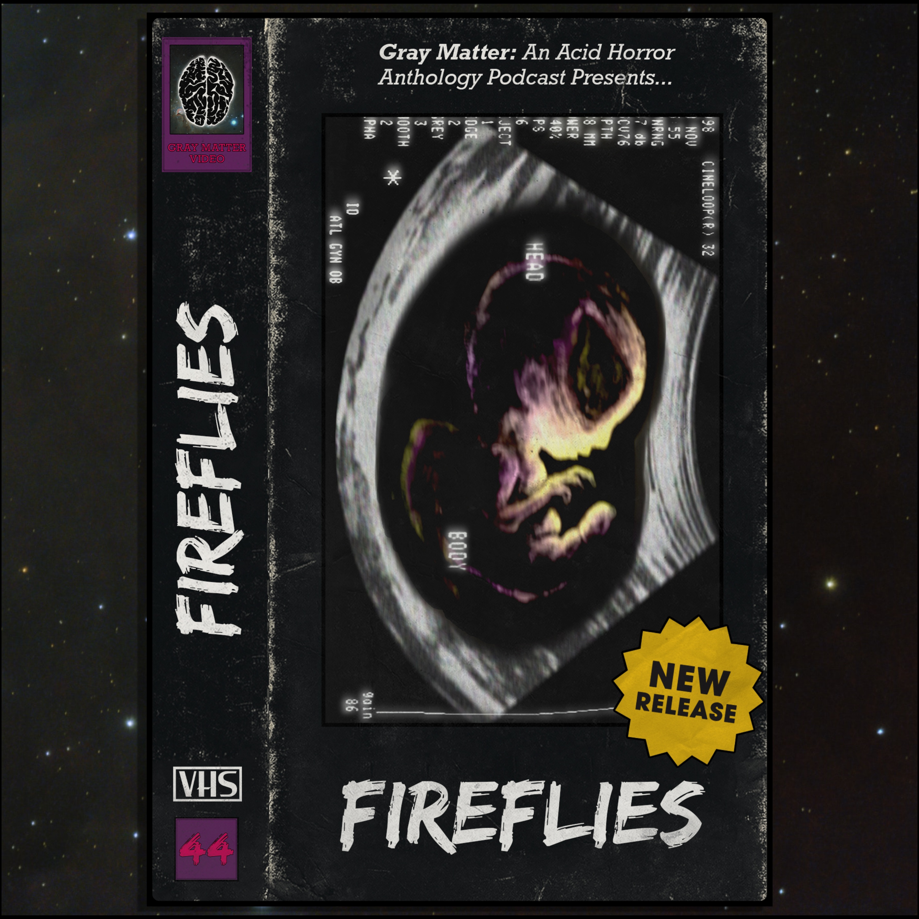 44 - Fireflies