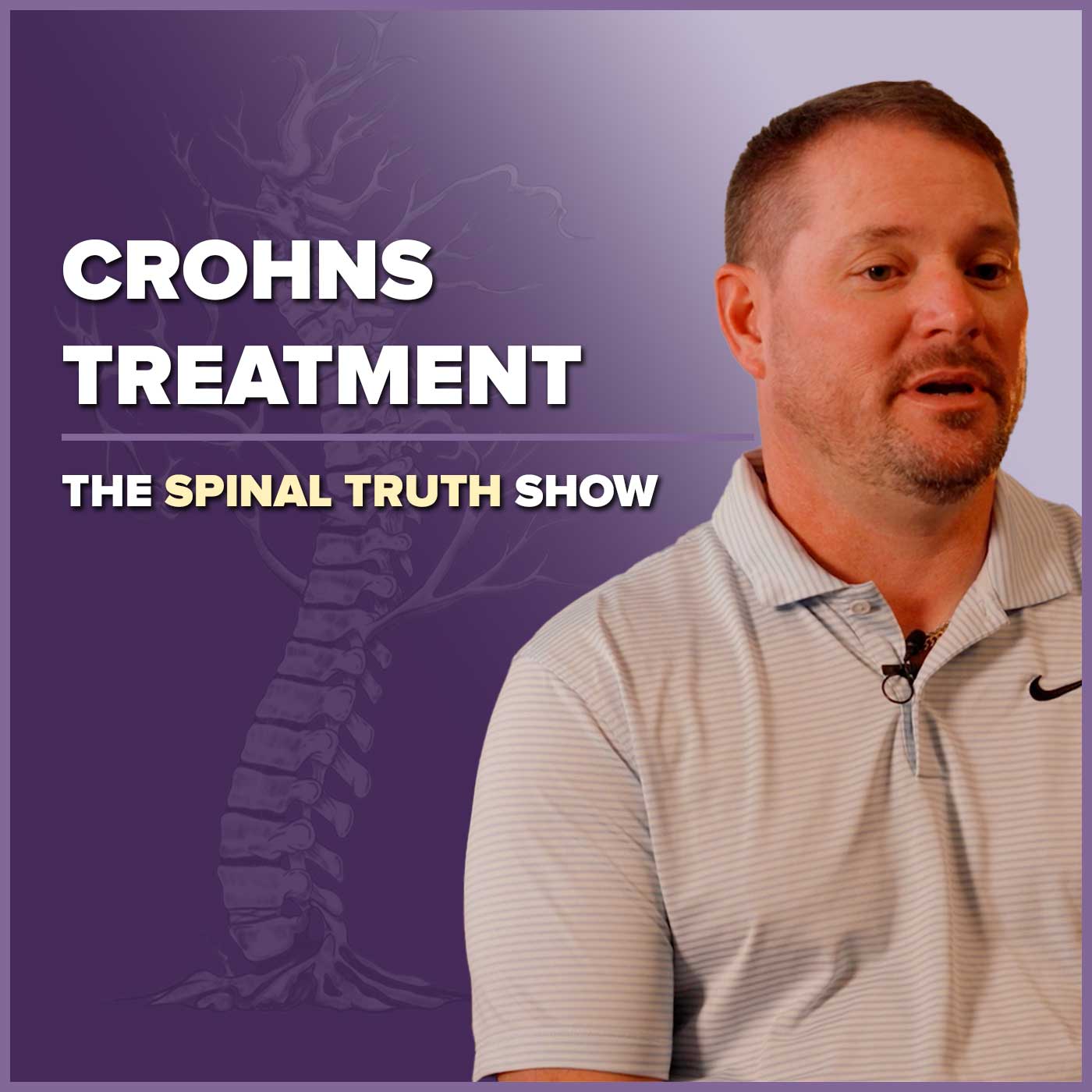 From Skeptic to Believer: How Spine Therapy Transformed My Crohn’s Symptoms
