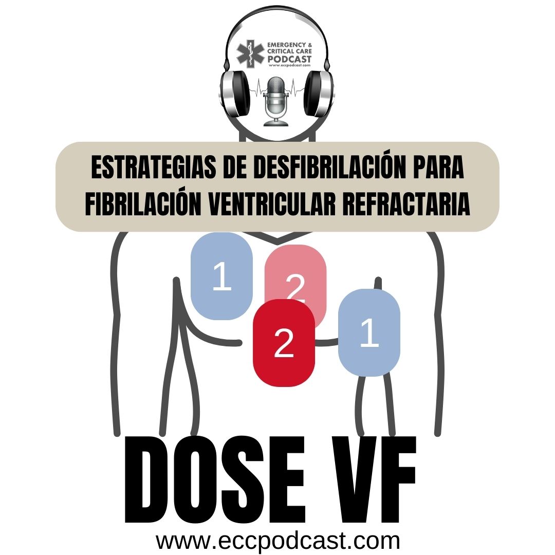 ¿Cómo desfibrilar la fibrilación ventricular refractaria?