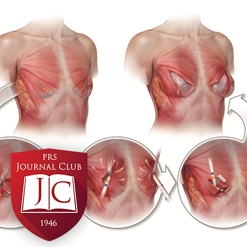 "Bimuscular Flap Technique" with Bradley Calobrace, MD - Dec. 2025 Journal Club