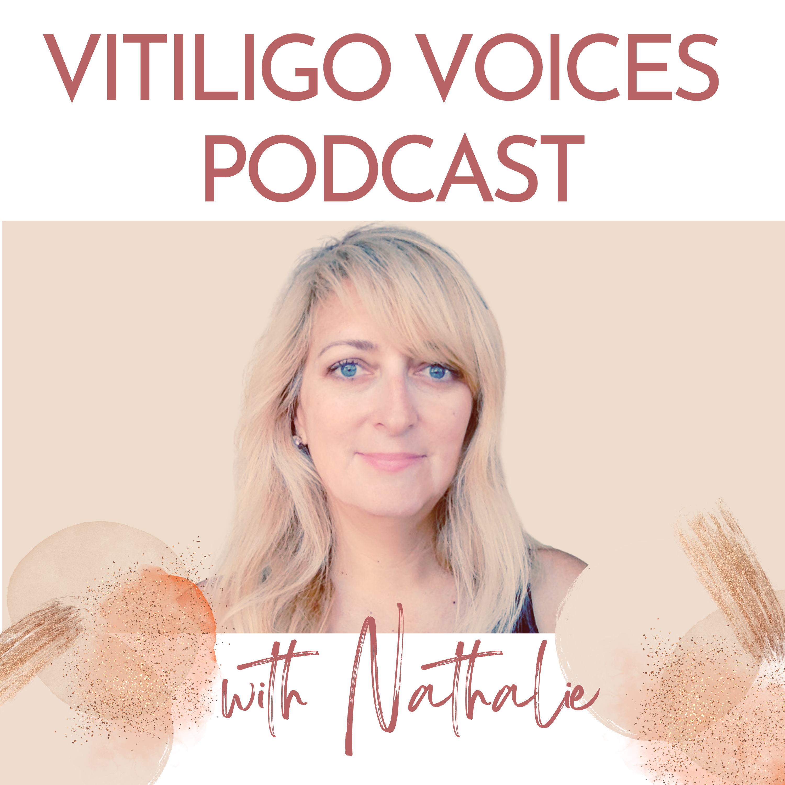 Vitiligo Cover Voices