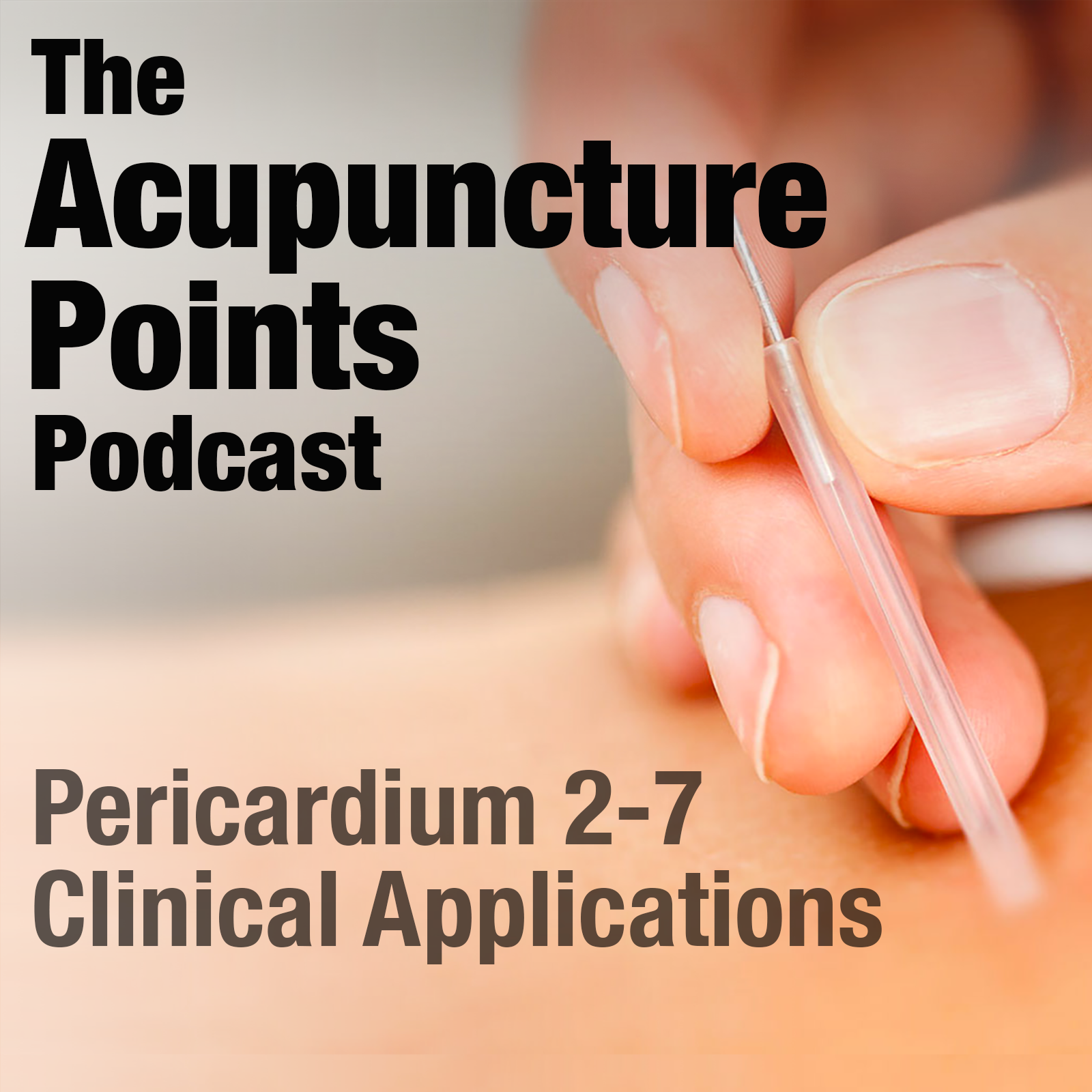 Acupuncture Points and their Clinical Application