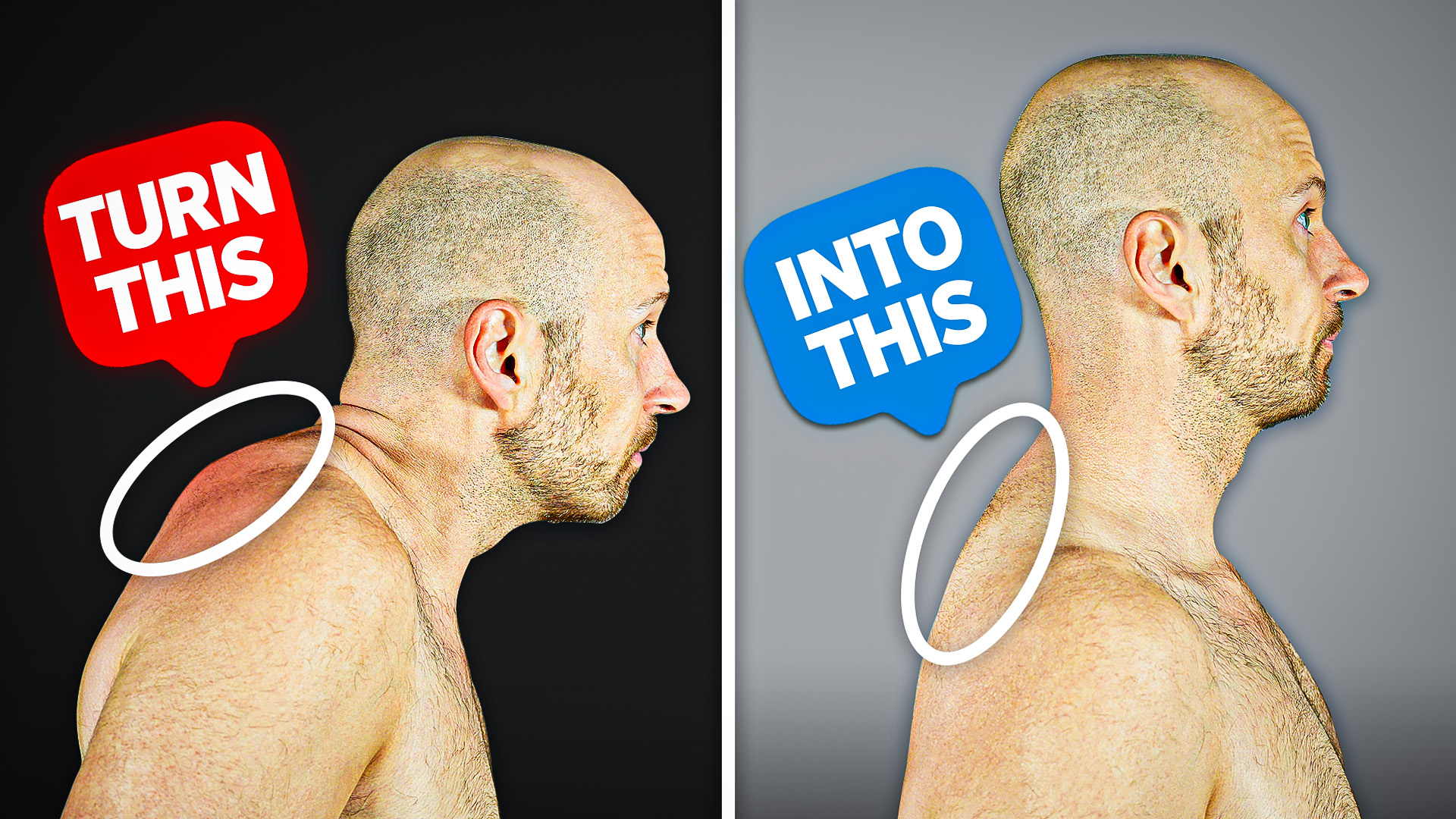 Fix Your Neck Hump FAST (10 Minutes a Day)