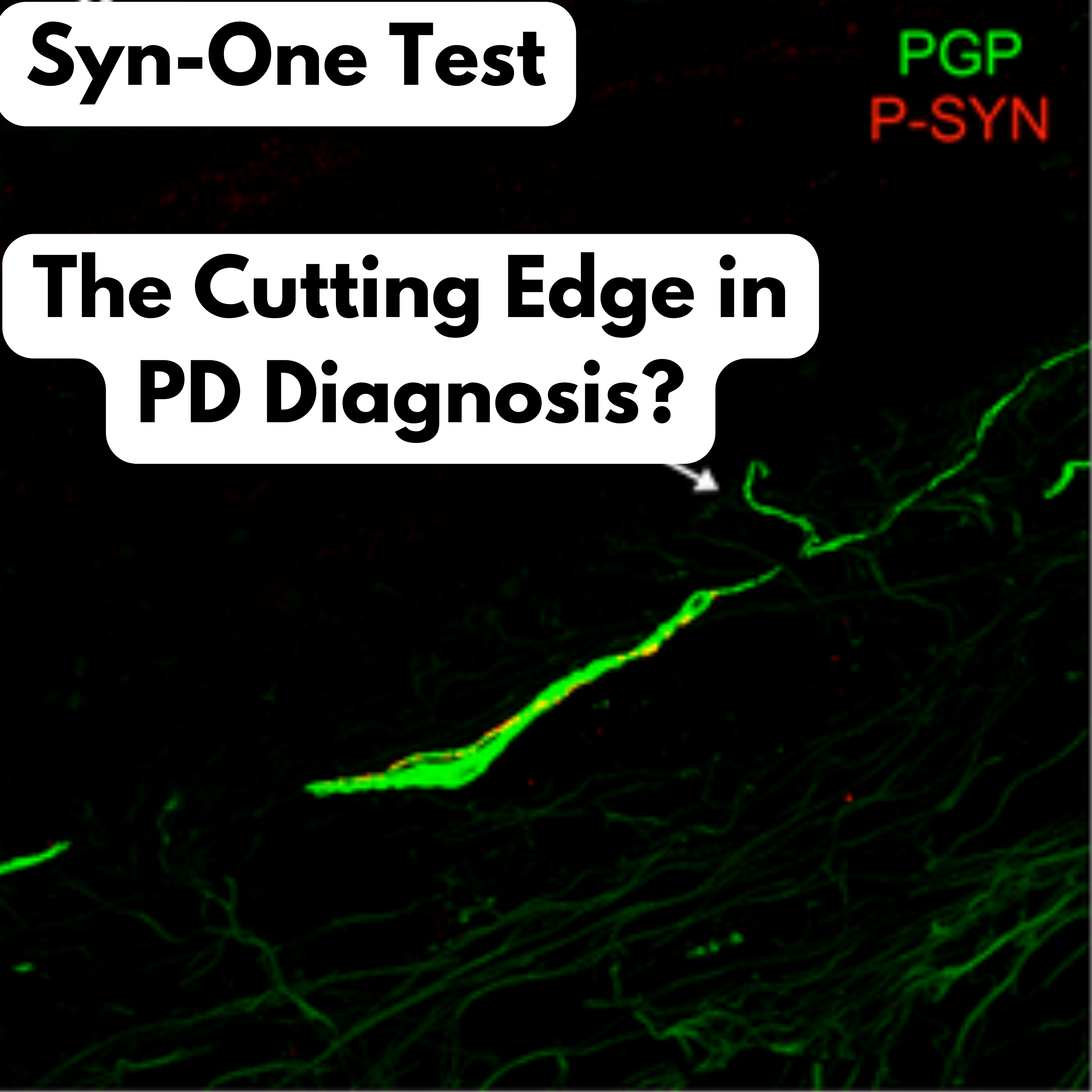 Parkinson\'s Disease Education Podcast
