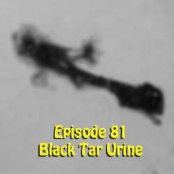 Ep 81: Black Tar Urine