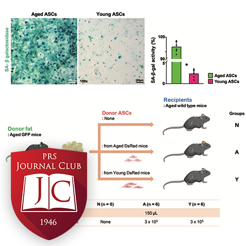 PRS Journal Club