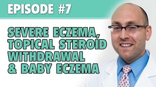 The Eczema Podcast