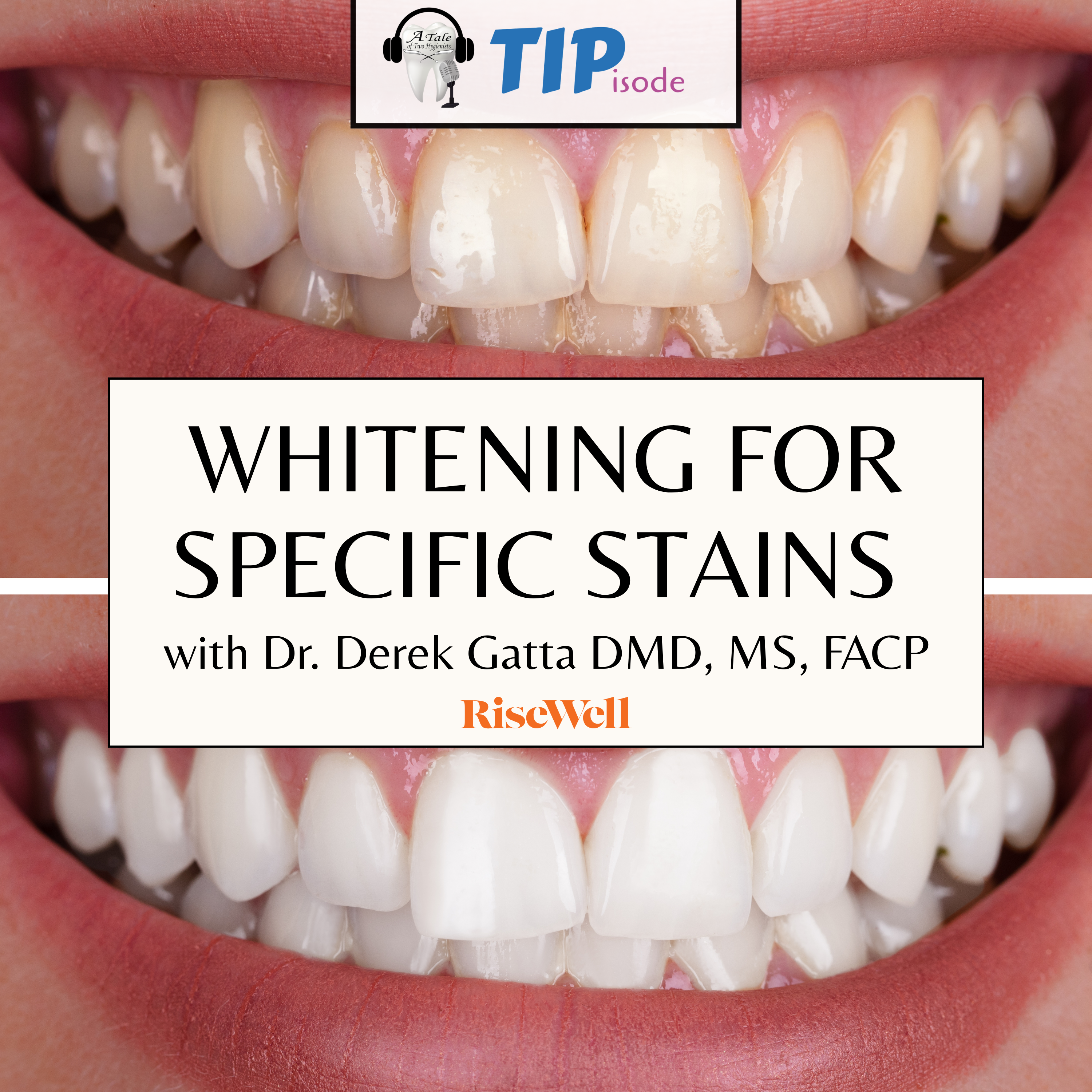 A Tale of Two Hygienists Podcast