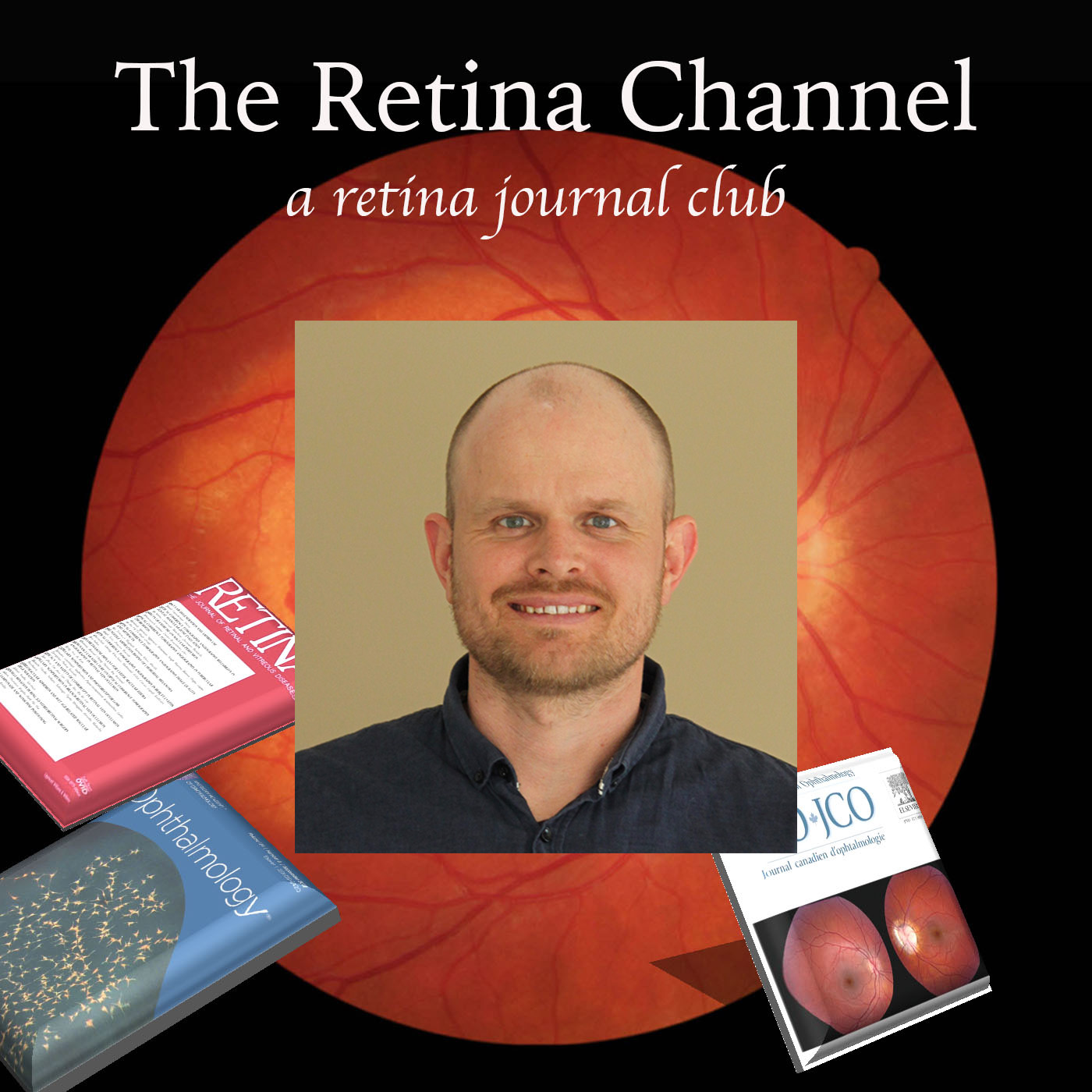The Retina Channel Podcast