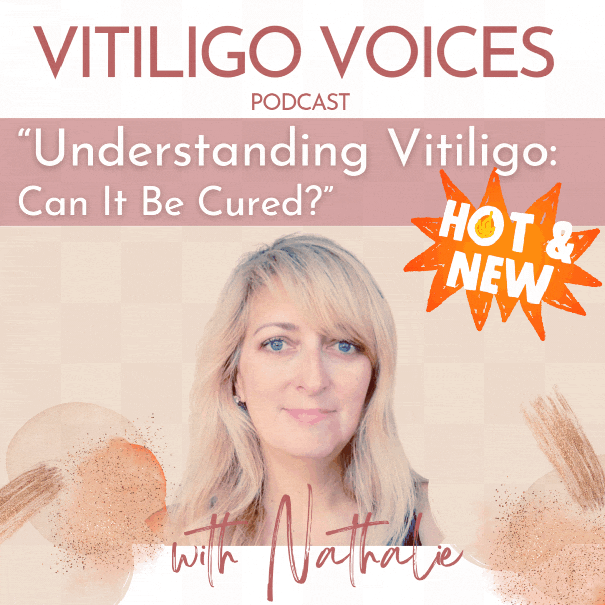 Understanding Vitiligo: Insights, Research, and Hope