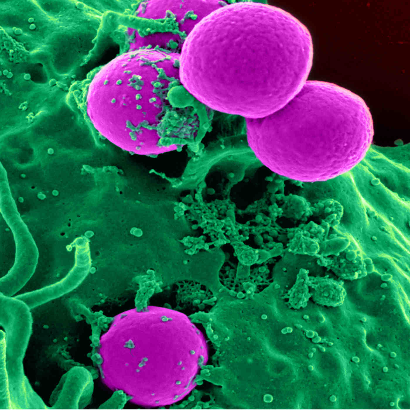 Is Antibiotic Resistance Evolution?