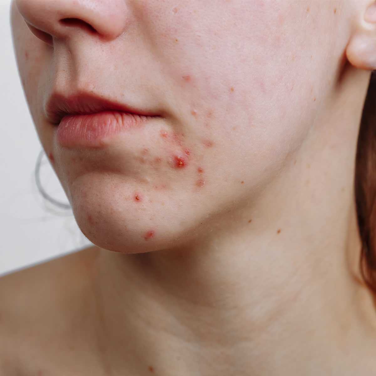 Skin Theory with Emme Diane