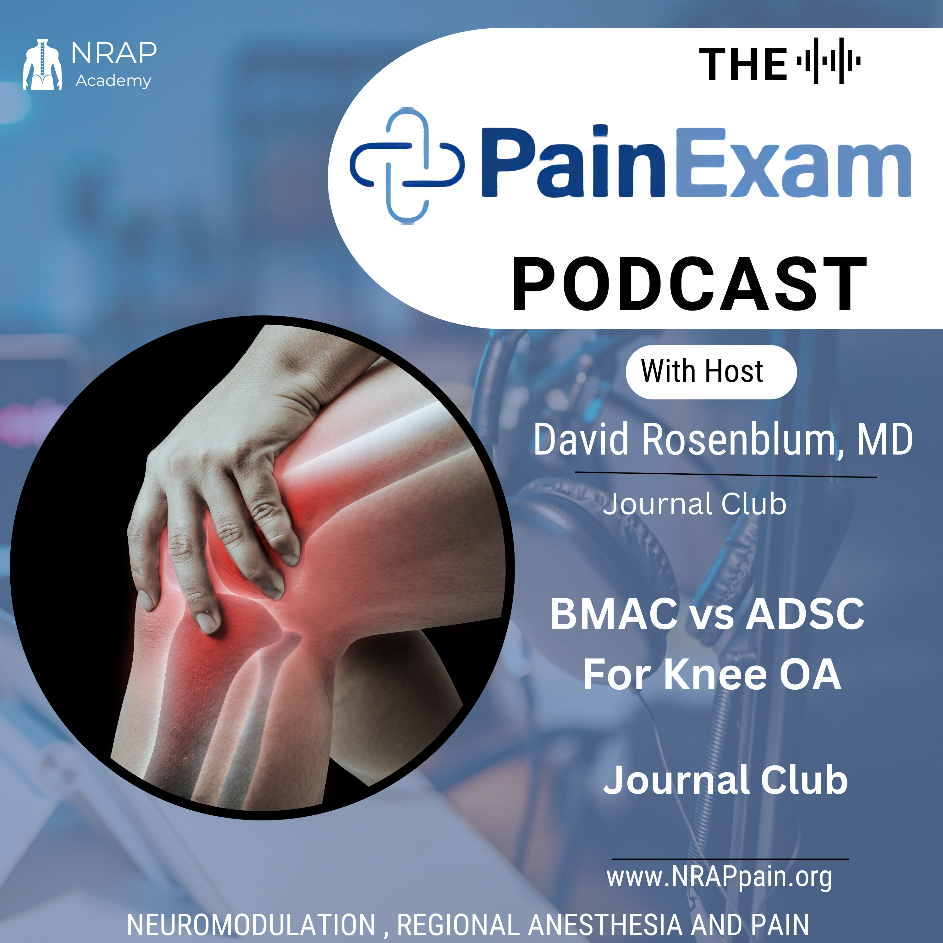 Exploring the Efficacy of BMAC and ADSC Injections in Knee Osteoarthritis