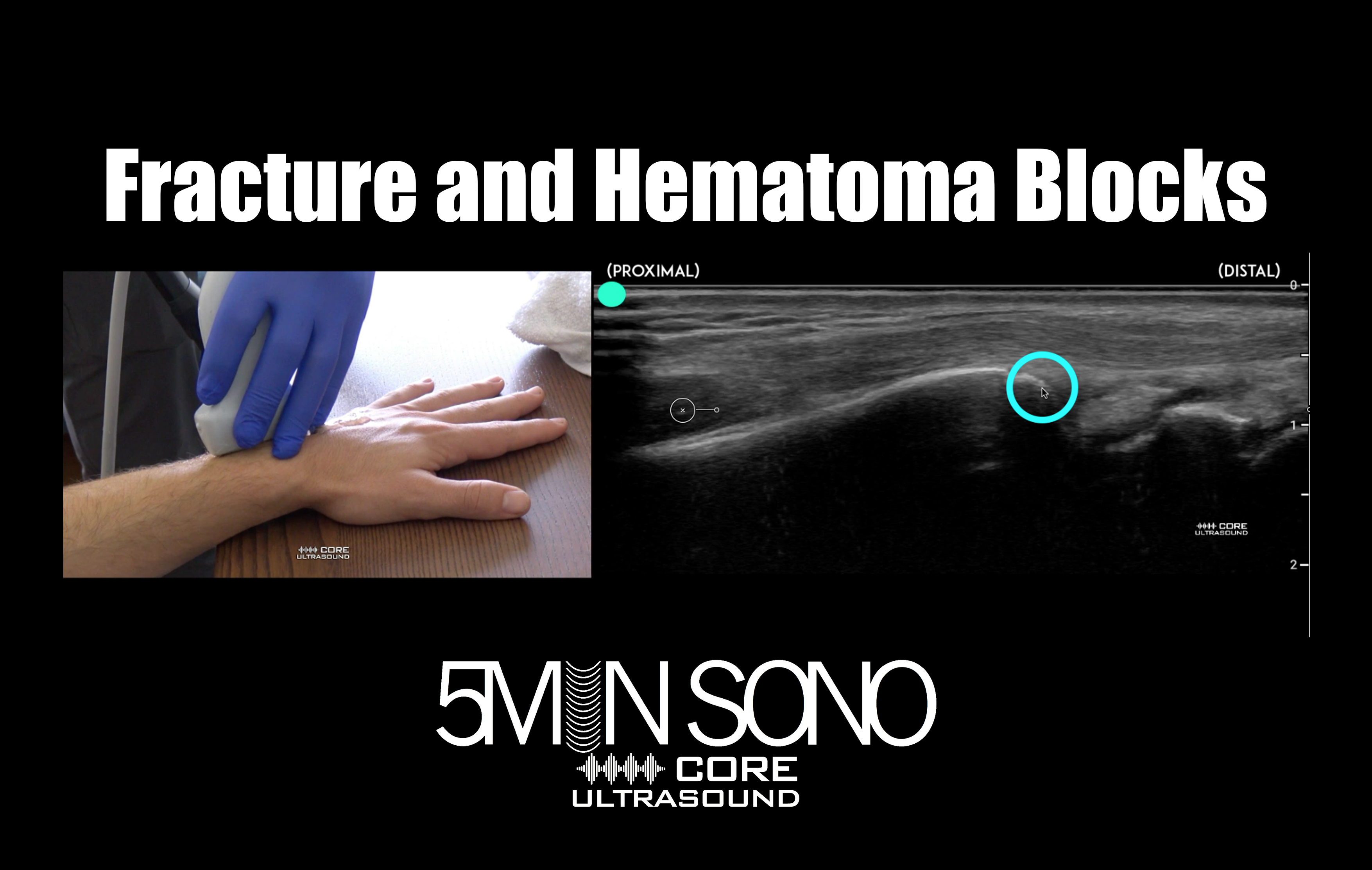 Find that fracture in seconds (and with no radiation!) AND perform that