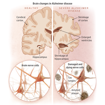 JAMA Medical News