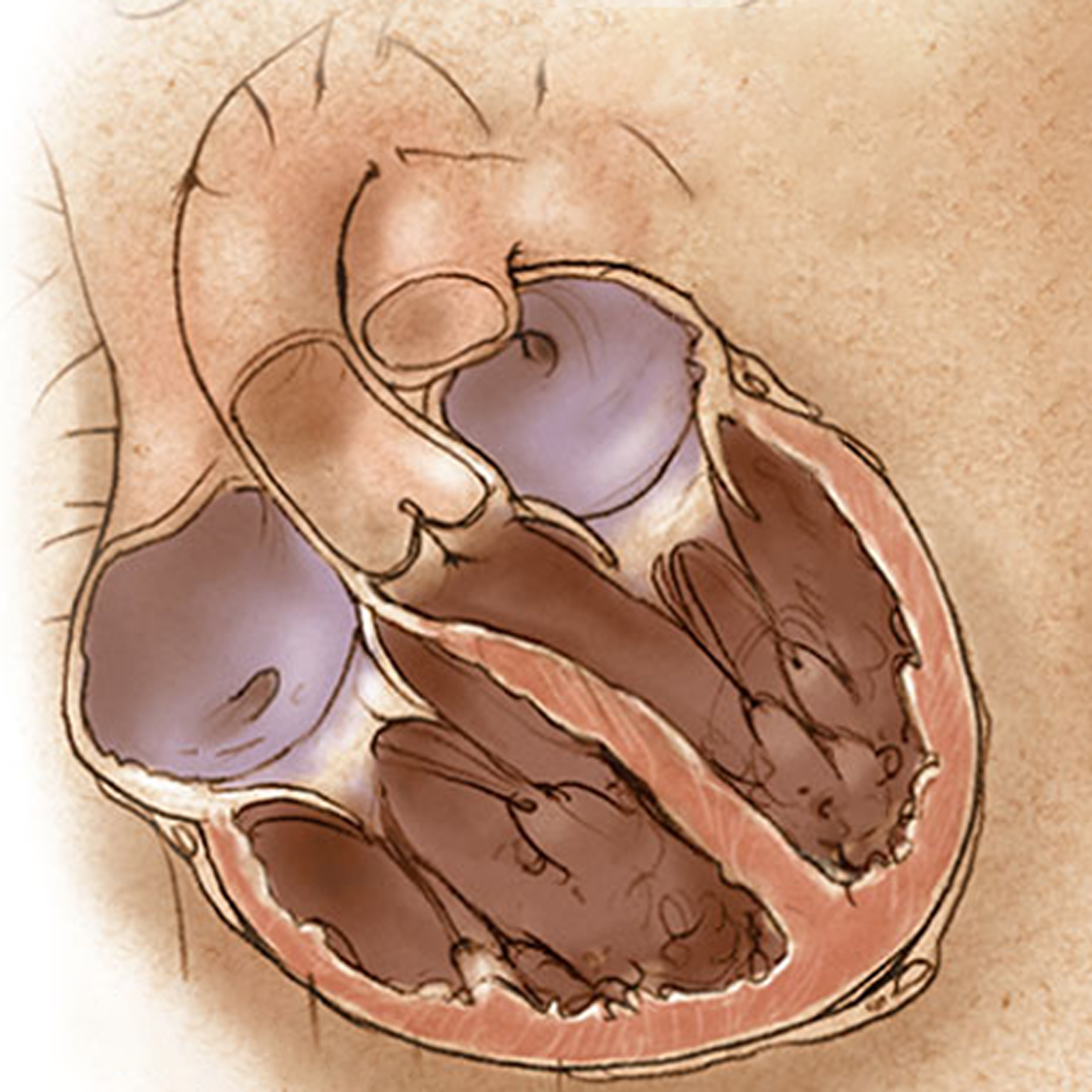 JAMA Cardiology Author Interviews