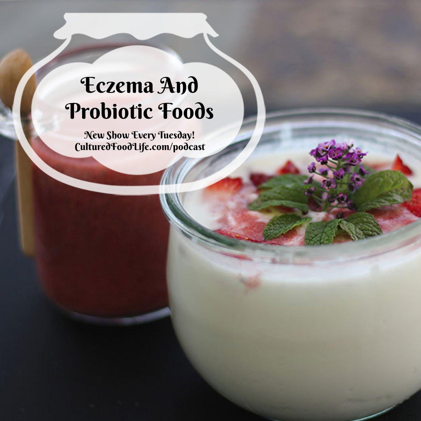 Episode 111: Eczema And Probiotic Foods