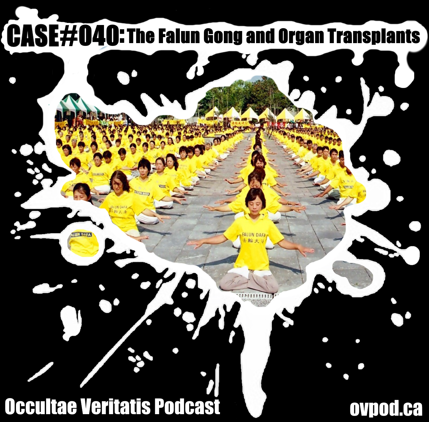 Case #040: The Falun Gong and Organ Transplants