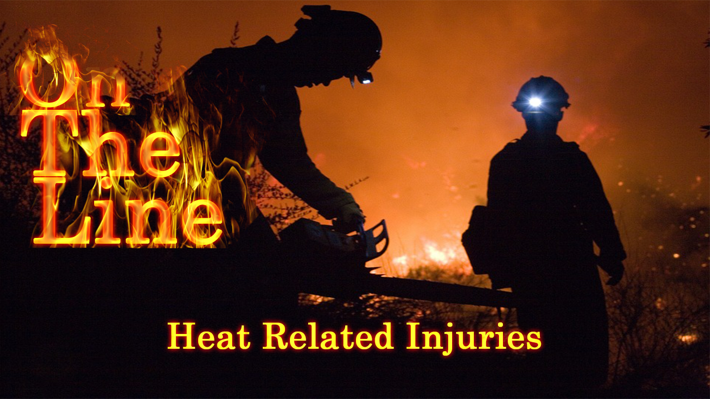 Heat Related Injuries