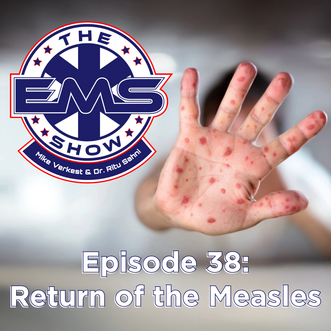 The EMS Show