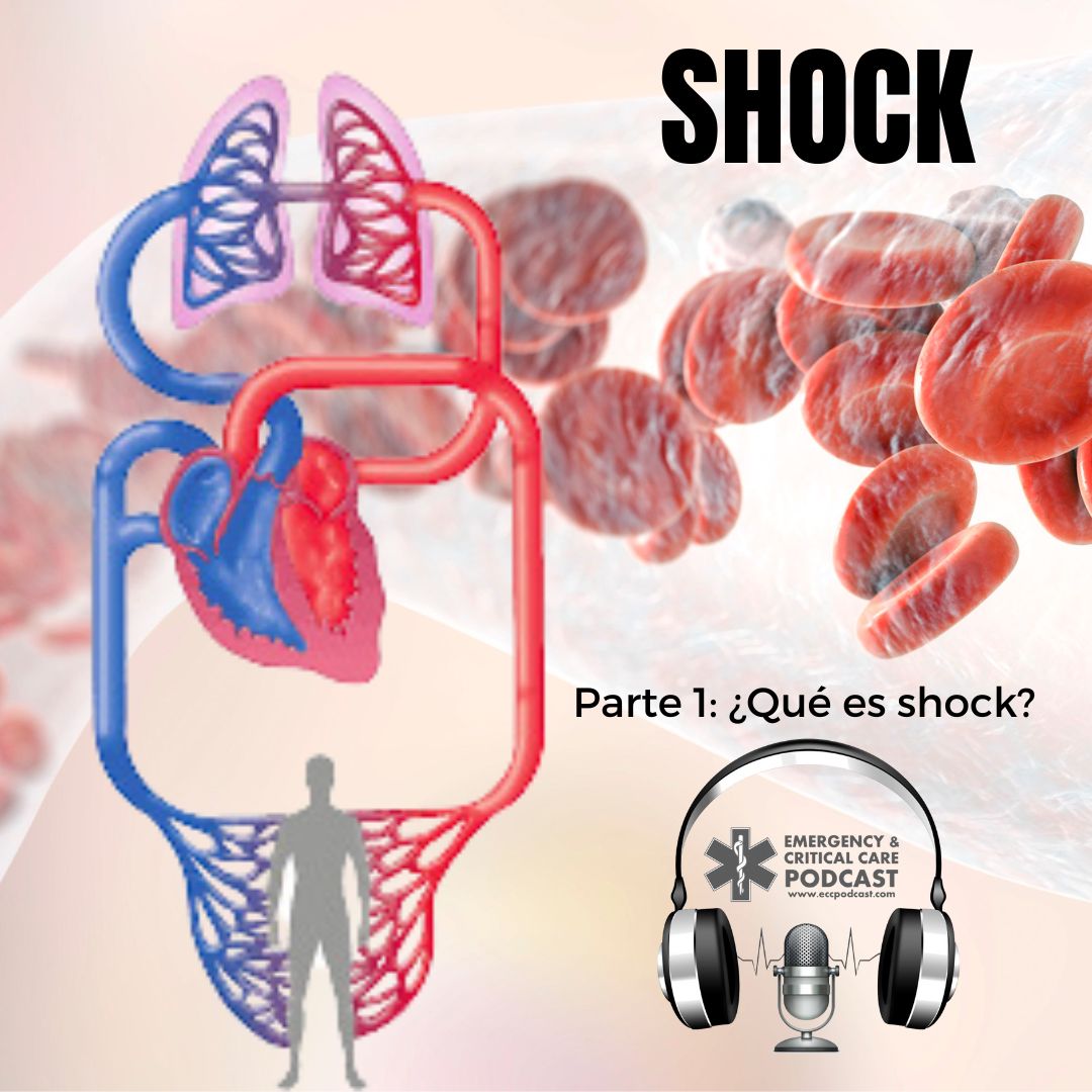 Shock - Parte 1
