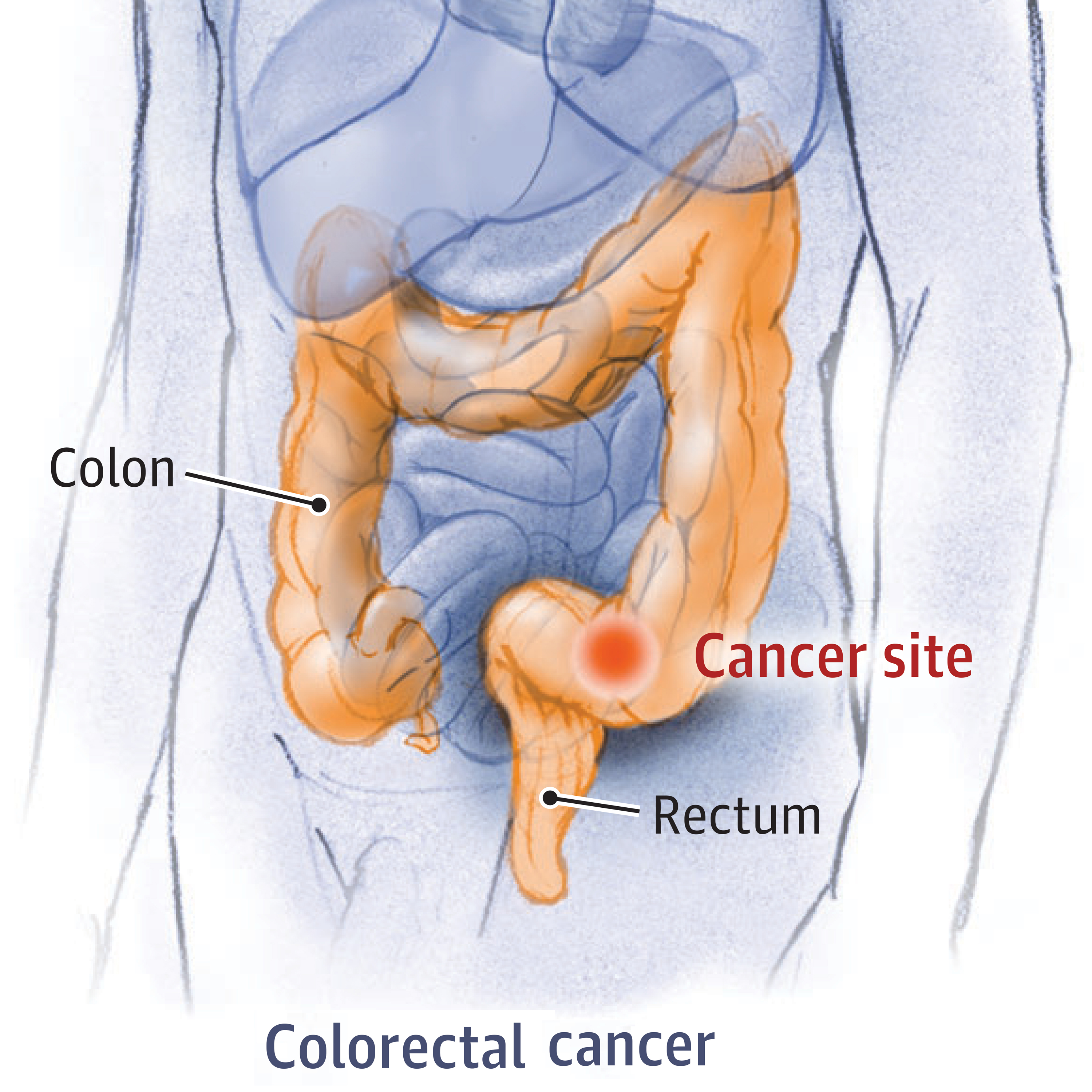 JAMA Medical News