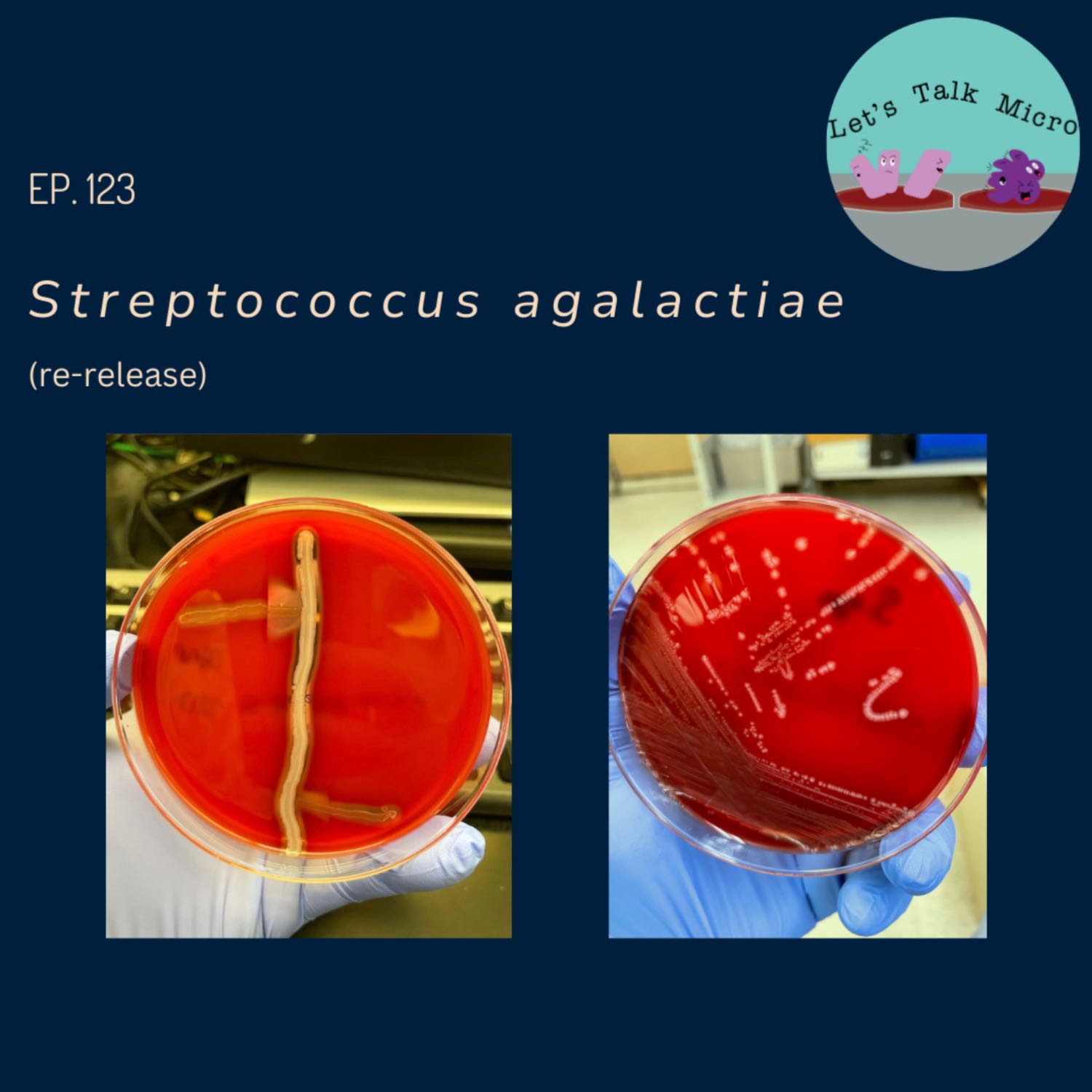 123: Streptococcus agalactiae (re-release)