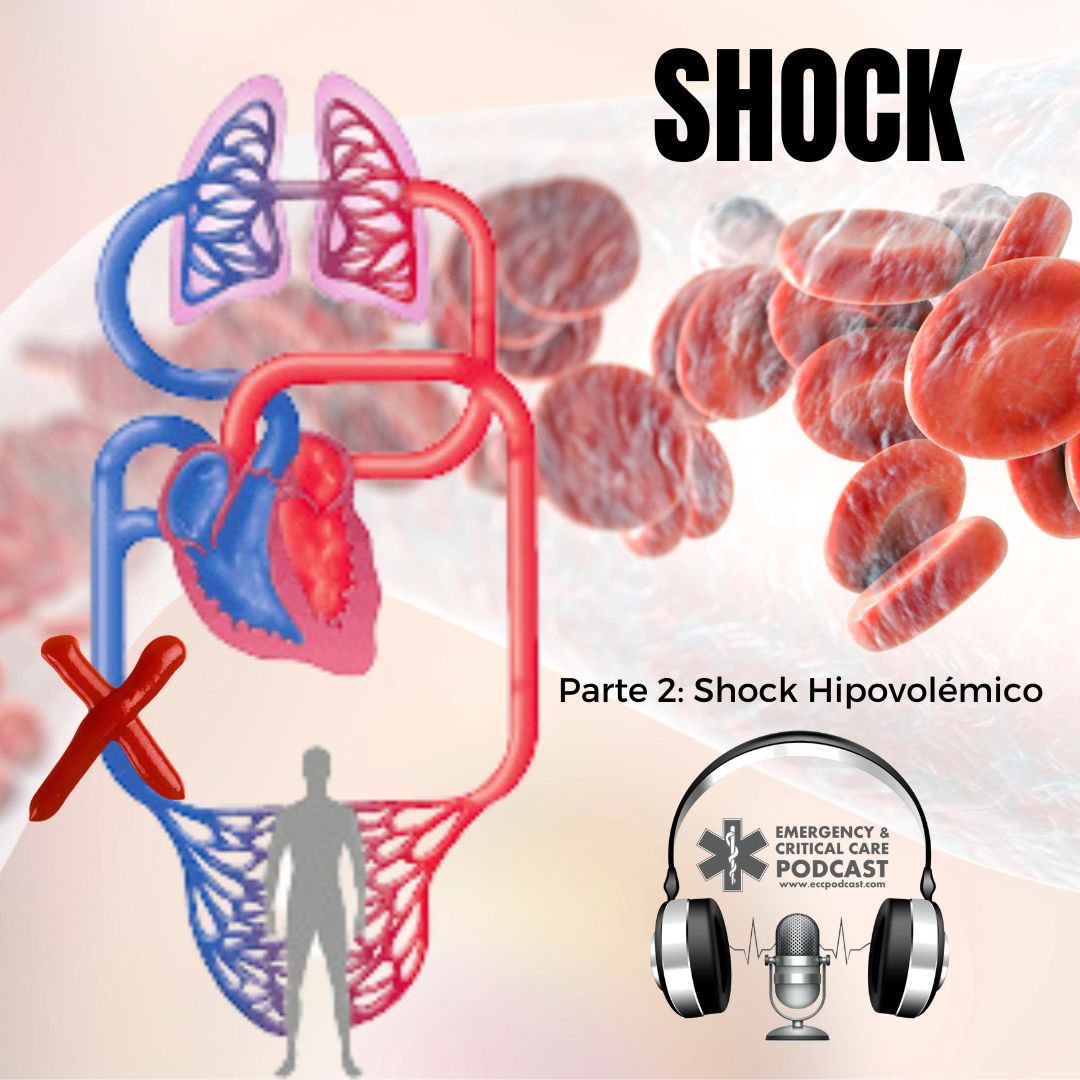 116. Shock: Parte 2