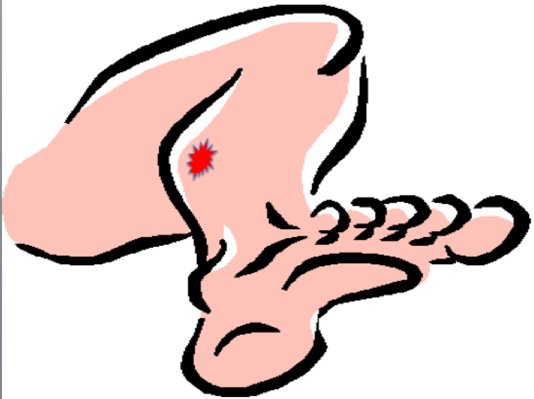 Pulmonary Embolism Signs, Symptoms & Documentation-recorded 10/05/17