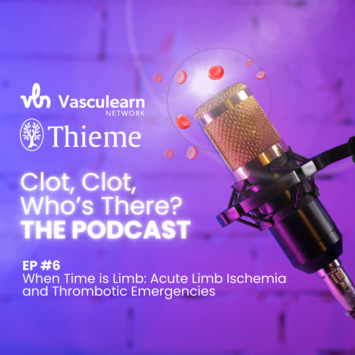 When Time is Limb: Acute Limb Ischemia and Thrombotic Emergencies