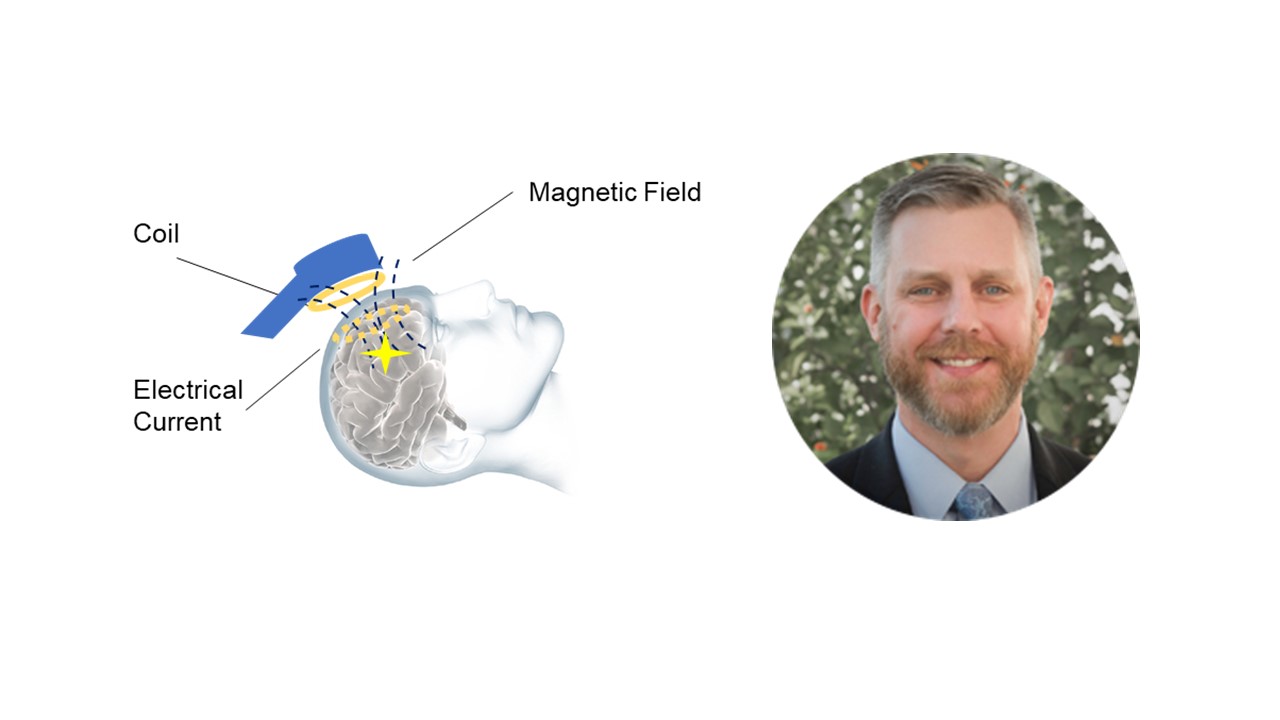 cover of episode E5 - Good Vibrations: What can transcranial magnetic stimulation do for mental health?