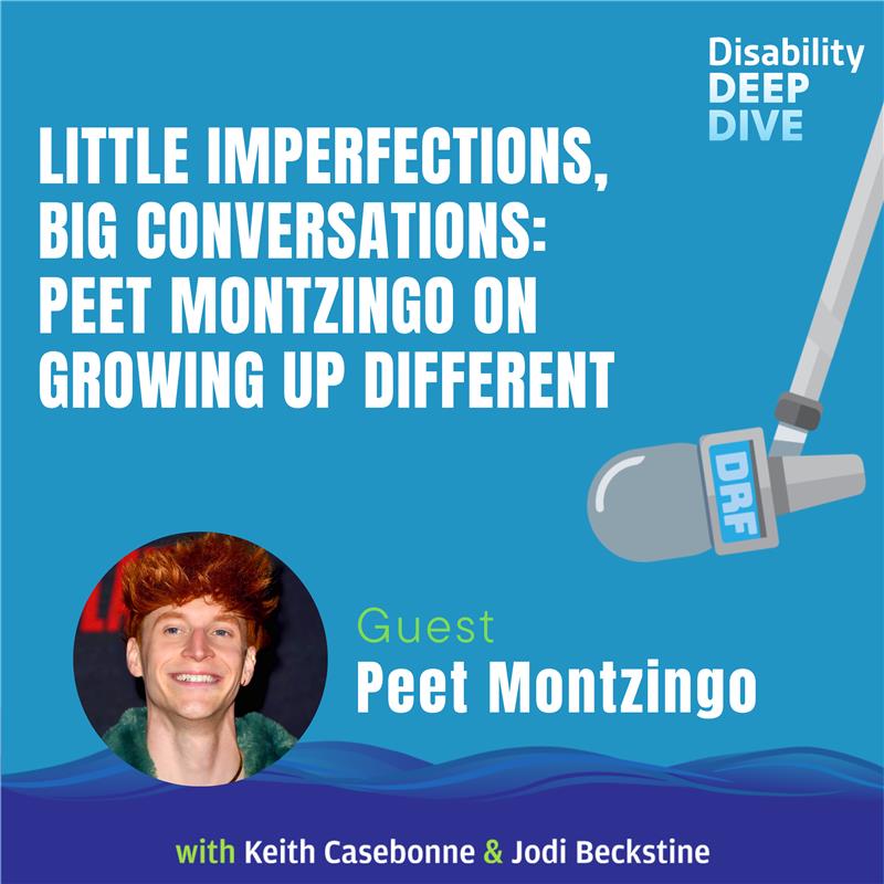 Little Imperfections, Big Conversations: Peet Montzingo on Growing Up Different